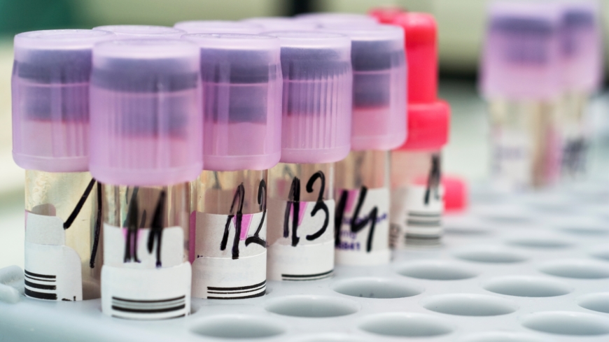 SR (sänka) – vad betyder provsvaret?